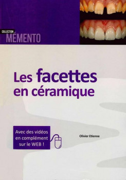 facettes en céramique.jpg